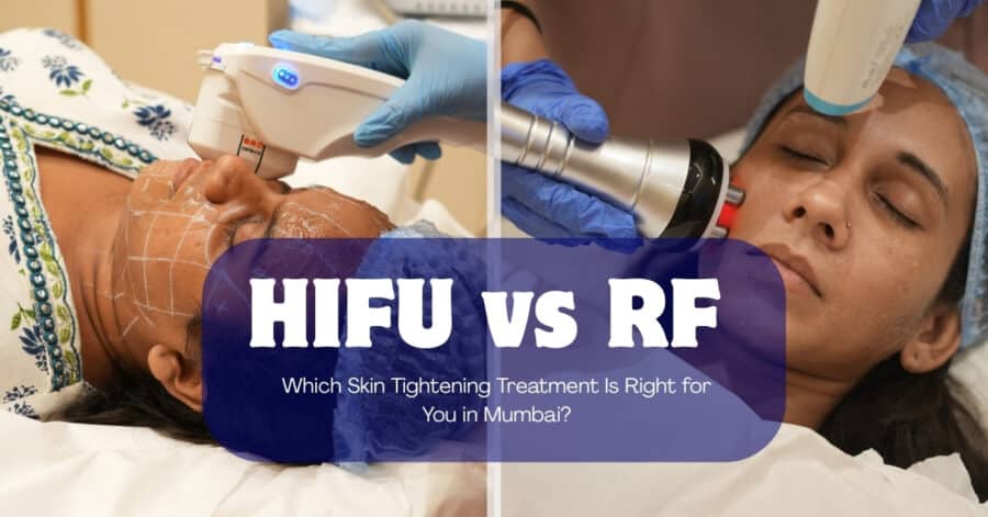 hifu vs rf skin tightening, rf vs hifu, hifu treatment mumbai, rf skin tightening treatment, Hifu Vs Rf Skin Tightening