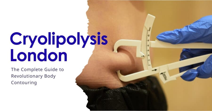 Cryolipolysis London