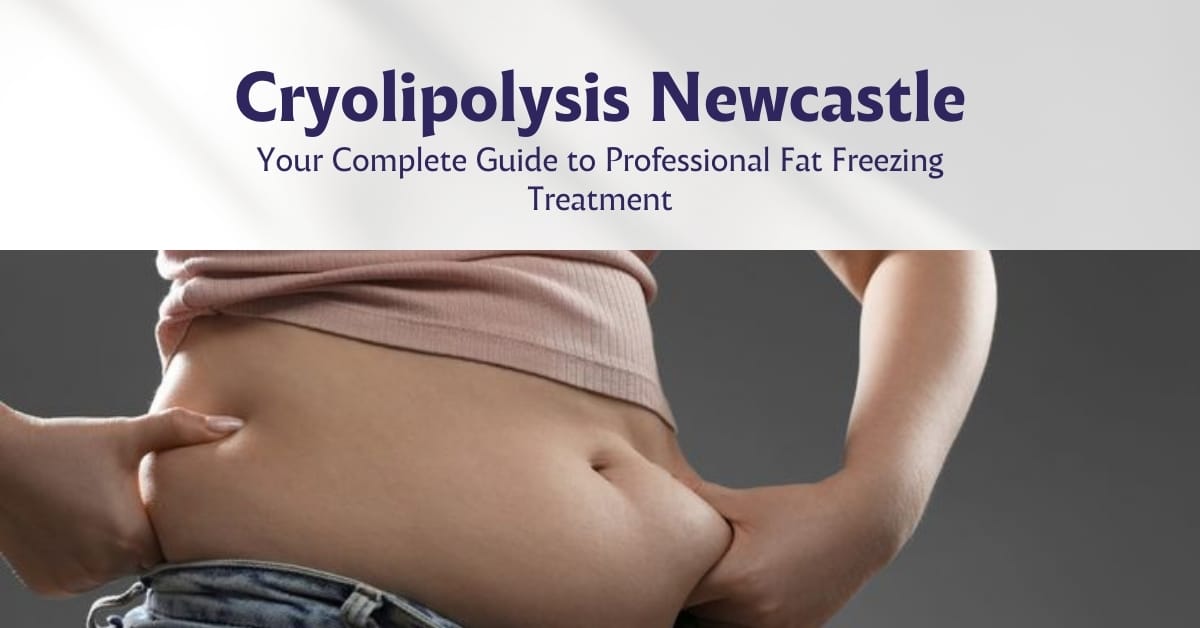 Cryolipolysis Newcastle