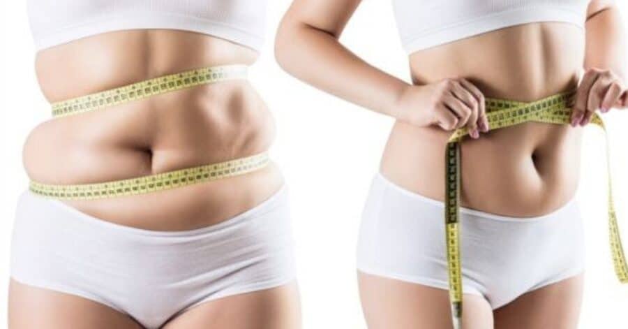 Cryolipolysis Misconceptions - Common Cryolipolysis Misconceptions Exposed Facts Vs Fiction Vivo Body Studio