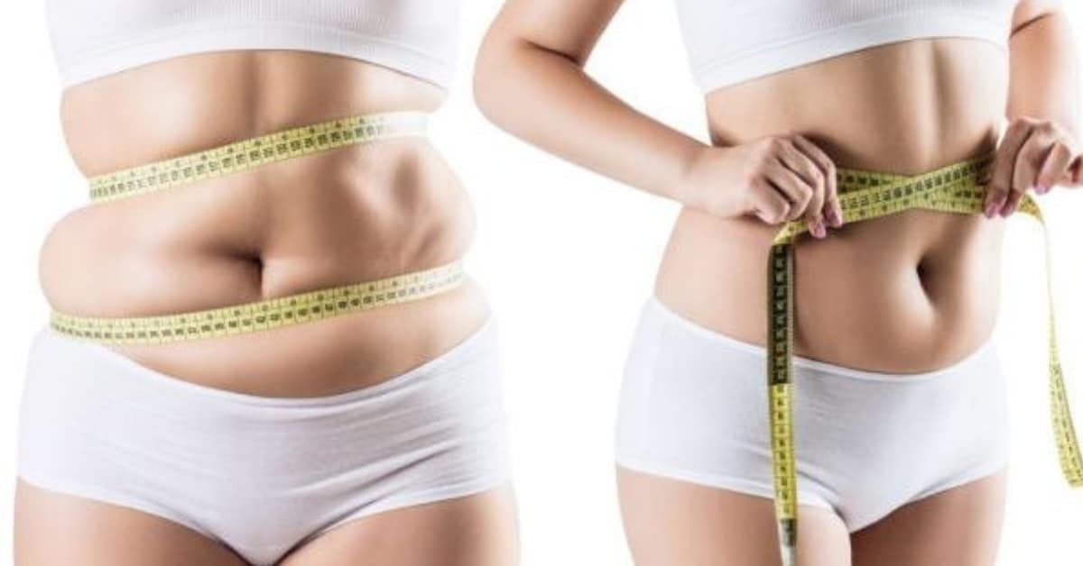 Cryolipolysis Misconceptions - Common Cryolipolysis Misconceptions Exposed Facts Vs Fiction Vivo Body Studio