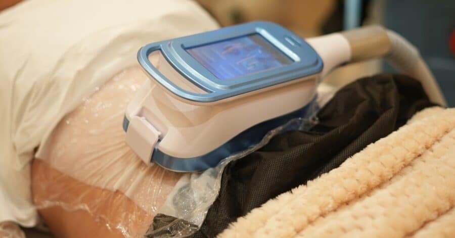 Cryolipolysis Treatment Plan Session Requirements Explained